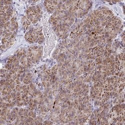 Invitrogen MP68 Polyclonal Antibody 100 &mu;L; Unconjugated:Antibodies,