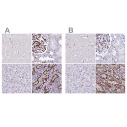 Invitrogen PITPNM3 Polyclonal Antibody 100 &mu;L; Unconjugated:Antibodies,