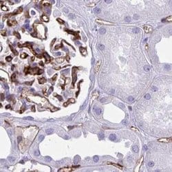 Invitrogen PITPNM3 Polyclonal Antibody 100 &mu;L; Unconjugated:Antibodies,