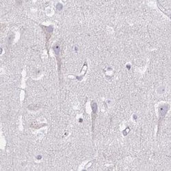 Invitrogen PITPNM3 Polyclonal Antibody 100 &mu;L; Unconjugated:Antibodies,