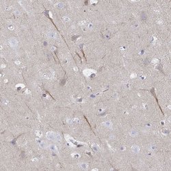 Invitrogen CEP170B Polyclonal Antibody 100 &mu;L; Unconjugated:Antibodies,
