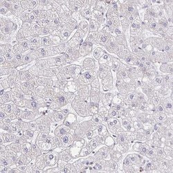 Invitrogen CEP170B Polyclonal Antibody 100 &mu;L; Unconjugated:Antibodies,