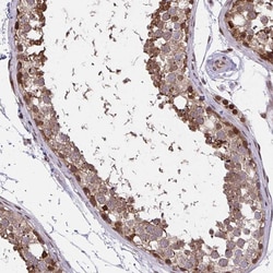 Invitrogen PIGY Polyclonal Antibody 100 &mu;L; Unconjugated:Antibodies,