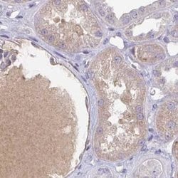 Invitrogen HGF Activator Polyclonal Antibody 100 &mu;L; Unconjugated:Antibodies,
