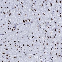 Invitrogen NOLA1 Polyclonal Antibody 100 &mu;L | Buy Online | Invitrogen&trade; | Fisher Scientific
