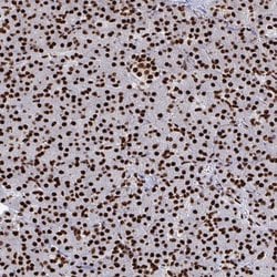 Invitrogen NOLA1 Polyclonal Antibody 100 &mu;L | Buy Online | Invitrogen&trade; | Fisher Scientific