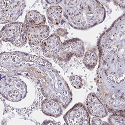 Invitrogen RAB6A Polyclonal Antibody 100 &mu;L; Unconjugated:Antibodies,