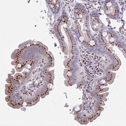Invitrogen RAB6A Polyclonal Antibody 100 &mu;L; Unconjugated:Antibodies,