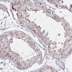 Invitrogen RAB6A Polyclonal Antibody 100 &mu;L; Unconjugated:Antibodies,