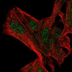 Invitrogen NFXL1 Polyclonal Antibody 100 &mu;L; Unconjugated:Antibodies,