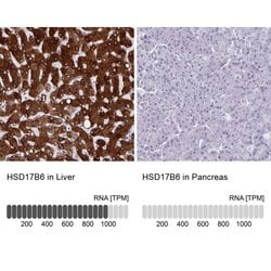 Invitrogen HSD17B6 Polyclonal Antibody 100 &mu;L; Unconjugated:Antibodies,