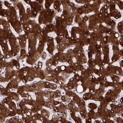 Invitrogen HSD17B6 Polyclonal Antibody 100 &mu;L; Unconjugated:Antibodies,
