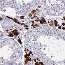 Invitrogen HSD17B6 Polyclonal Antibody 100 &mu;L; Unconjugated:Antibodies,