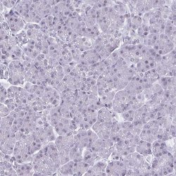Invitrogen HSD17B6 Polyclonal Antibody 100 &mu;L; Unconjugated:Antibodies,