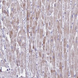Invitrogen BCL6B Polyclonal Antibody 100 &mu;L; Unconjugated:Antibodies,
