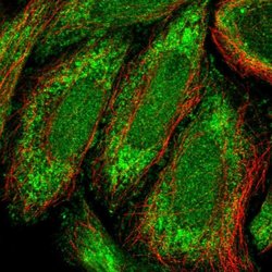 Invitrogen ZNF684 Polyclonal Antibody 100 &mu;L; Unconjugated:Antibodies,