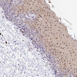 Invitrogen ZNF684 Polyclonal Antibody 100 &mu;L; Unconjugated:Antibodies,