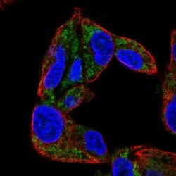 Invitrogen CYP27A1 Polyclonal Antibody 100 &mu;L | Buy Online | Invitrogen&trade; | Fisher Scientific