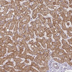 Invitrogen CYP27A1 Polyclonal Antibody 100 &mu;L | Buy Online | Invitrogen&trade; | Fisher Scientific