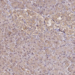 Invitrogen CYP27A1 Polyclonal Antibody 100 &mu;L | Buy Online | Invitrogen&trade; | Fisher Scientific