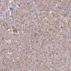Invitrogen CYP27A1 Polyclonal Antibody 100 &mu;L | Buy Online | Invitrogen&trade; | Fisher Scientific