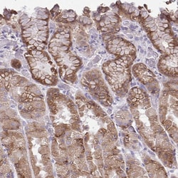 Invitrogen CHIA Polyclonal Antibody 100 &mu;L; Unconjugated:Antistoffer