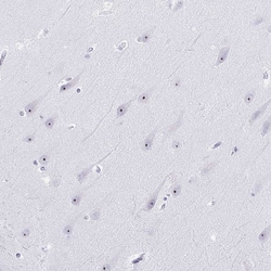 Invitrogen NOLA3 Polyclonal Antibody 100 &mu;L; Unconjugated:Antibodies,