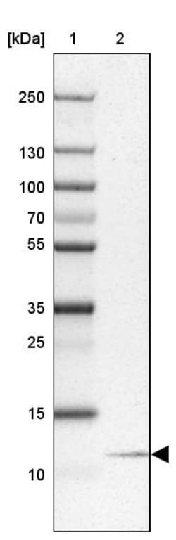 Invitrogen NOLA3 Polyclonal Antibody 100 &mu;L; Unconjugated:Antibodies,