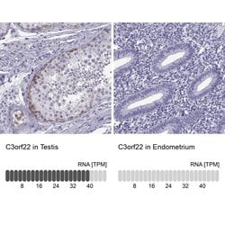 Invitrogen C3orf22 Polyclonal Antibody 100 &mu;L; Unconjugated:Antibodies,