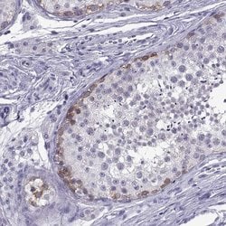 Invitrogen C3orf22 Polyclonal Antibody 100 &mu;L; Unconjugated:Antibodies,