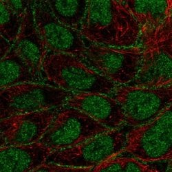 Invitrogen FOXN3 Polyclonal Antibody 100 &mu;L; Unconjugated:Antibodies,