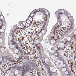 Invitrogen FOXN3 Polyclonal Antibody 100 &mu;L; Unconjugated:Antibodies,