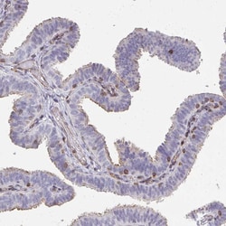 Invitrogen FOXN3 Polyclonal Antibody 100 &mu;L; Unconjugated:Antibodies,