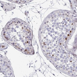 Invitrogen FOXN3 Polyclonal Antibody 100 &mu;L; Unconjugated:Antibodies,