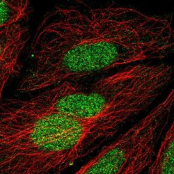 Invitrogen ZNF362 Polyclonal Antibody 100 &mu;L; Unconjugated:Antibodies,