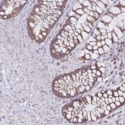 Invitrogen ZNF362 Polyclonal Antibody 100 &mu;L; Unconjugated:Antibodies,