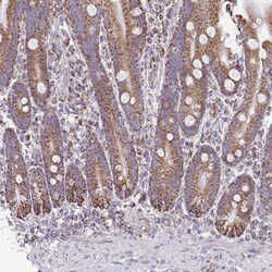 Invitrogen ZNF362 Polyclonal Antibody 100 &mu;L | Buy Online | Invitrogen&trade; | Fisher Scientific