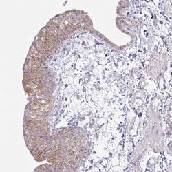 Invitrogen NDUFA7 Polyclonal Antibody 100 &mu;L; Unconjugated:Antibodies,