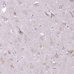 Invitrogen DTX4 Polyclonal Antibody 100 &mu;L; Unconjugated:Antibodies,