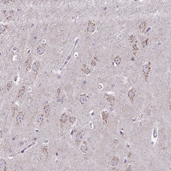 Invitrogen DTX4 Polyclonal Antibody 100 &mu;L; Unconjugated:Antibodies,