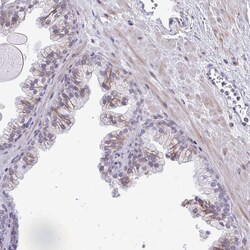 Invitrogen DTX4 Polyclonal Antibody 100 &mu;L; Unconjugated:Antibodies,