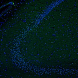 Invitrogen DTX4 Polyclonal Antibody 100 &mu;L; Unconjugated:Antibodies,
