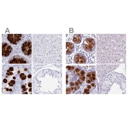 Invitrogen CLCA1 Polyclonal Antibody 100 &mu;L; Unconjugated:Antibodies,