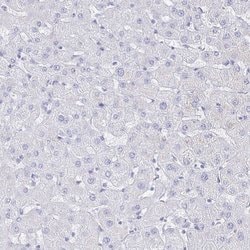 Invitrogen CLCA1 Polyclonal Antibody 100 &mu;L; Unconjugated:Antibodies,
