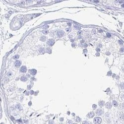 Invitrogen CLCA1 Polyclonal Antibody 100 &mu;L; Unconjugated:Antibodies,