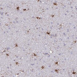 Invitrogen ASPH Polyclonal Antibody 100 &mu;L; Unconjugated:Antibodies,