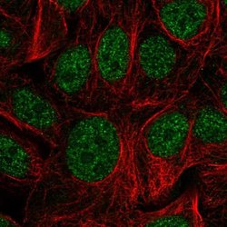Invitrogen ZDHHC12 Polyclonal Antibody 100 &mu;L; Unconjugated:Antibodies,