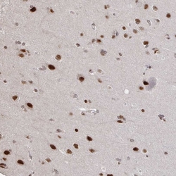 Invitrogen ZDHHC12 Polyclonal Antibody 100 &mu;L; Unconjugated:Antibodies,