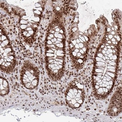 Invitrogen ZDHHC12 Polyclonal Antibody 100 &mu;L; Unconjugated:Antibodies,