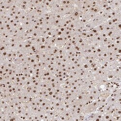 Invitrogen ZDHHC12 Polyclonal Antibody 100 &mu;L; Unconjugated:Antibodies,
